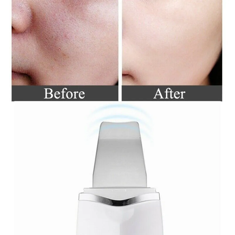 Ultra-Sonic Deep Facial Cleansing Machine Facial Scrubber- USB Charging