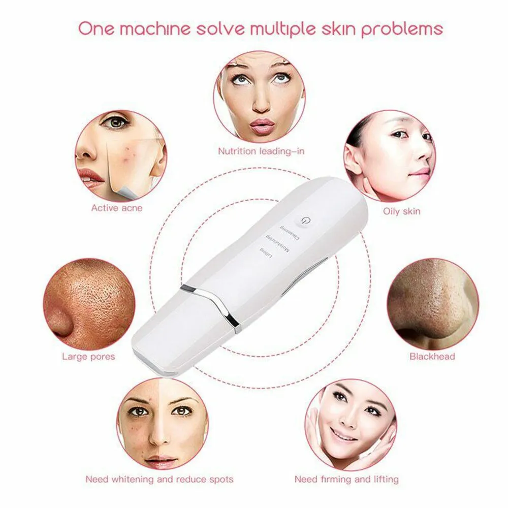 Ultra-Sonic Deep Facial Cleansing Machine Facial Scrubber- USB Charging