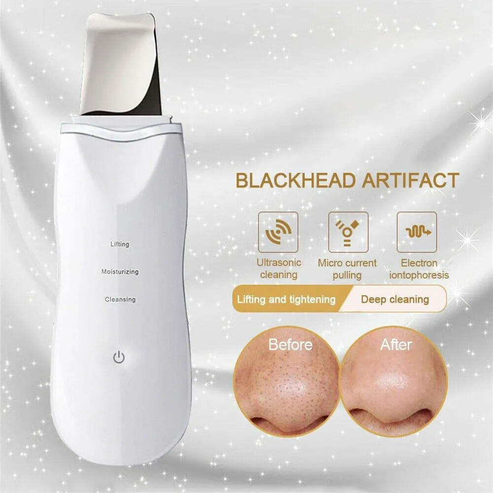 Ultra-Sonic Deep Facial Cleansing Machine Facial Scrubber- USB Charging